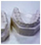 Traditional orthodontics plaster model of teeth